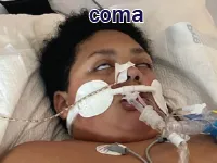 Định nghĩa của từ <b>coma</b>