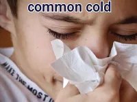 Định nghĩa của từ <b>common cold</b>