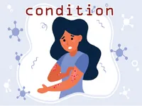 Định nghĩa của từ <b>condition</b>