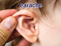 Định nghĩa của từ <b>earache</b>