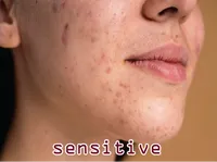 Định nghĩa của từ <b>sensitive</b>