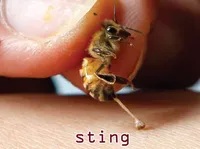 Định nghĩa của từ <b>sting</b>